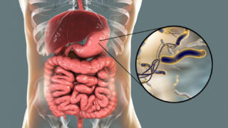 Паразитоз: мифы, реальные симптомы и антипаразитарное питание